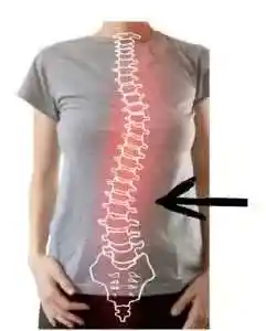 Bol-kregoslupawada-postawy-kielce Fizjorecover